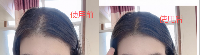 海瑟薇防脱洗发水口碑深度测评:当发质改善成为防脱的有力说明